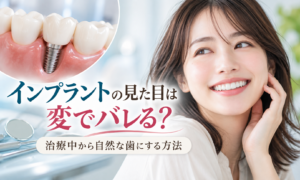 インプラントの見た目は変でバレる？治療中から自然な歯にする方法