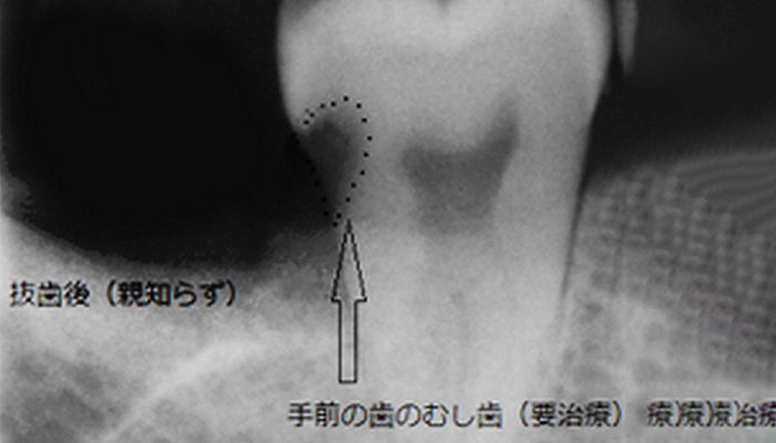 歯科画像